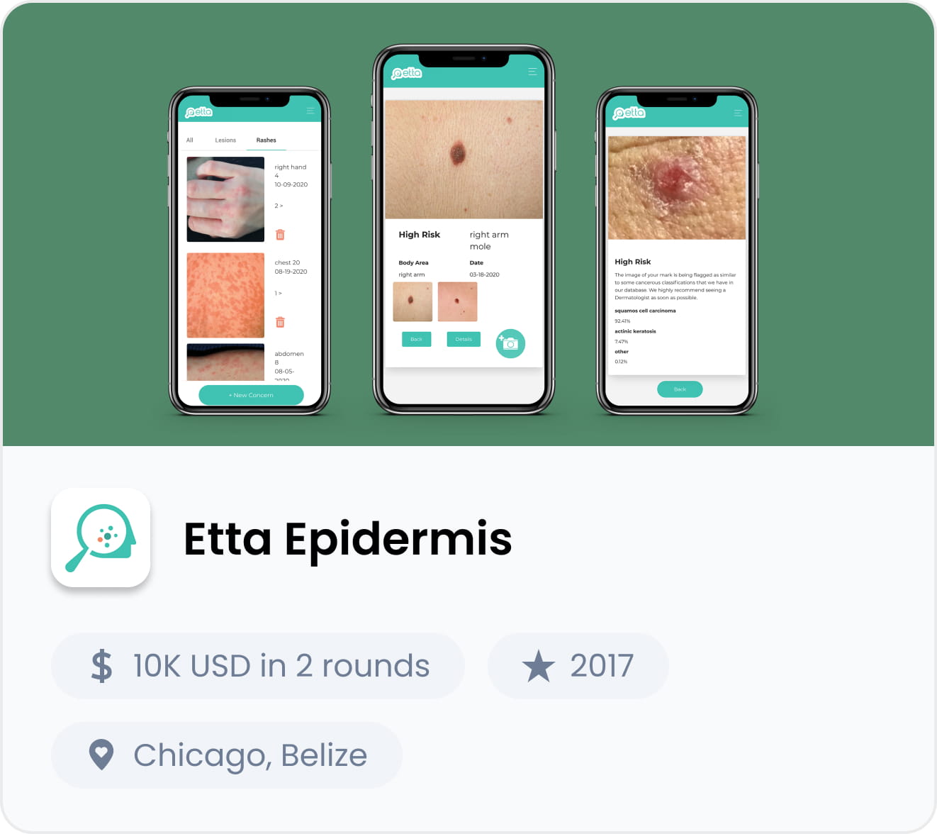 Etta Epidermis